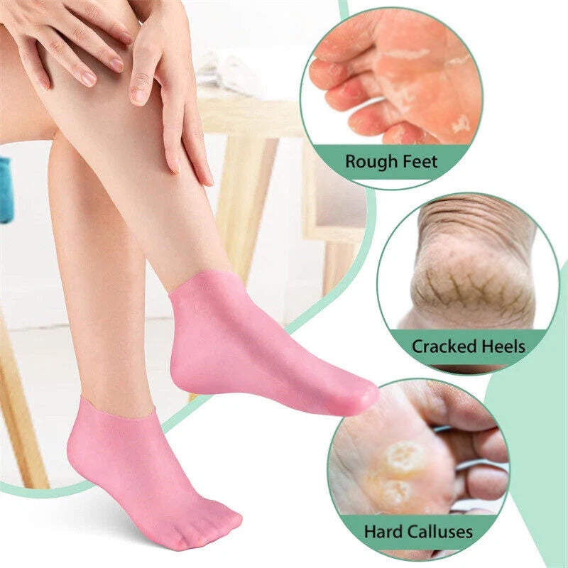 1 Pair Silicone Moisturizing Gel Heel Socks – Cracked Heel Repair & Foot Care Solution