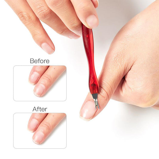 Dead Skin Fork – Effective Callus Remover Tool for Smooth & Soft Skin