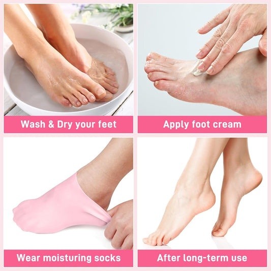 1 Pair Silicone Moisturizing Gel Heel Socks – Cracked Heel Repair & Foot Care Solution